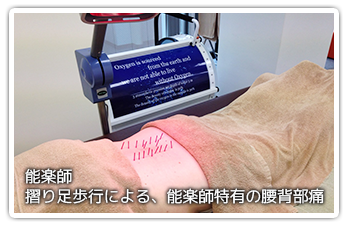 能楽師 摺り足歩行による、能楽師特有の腰背部痛